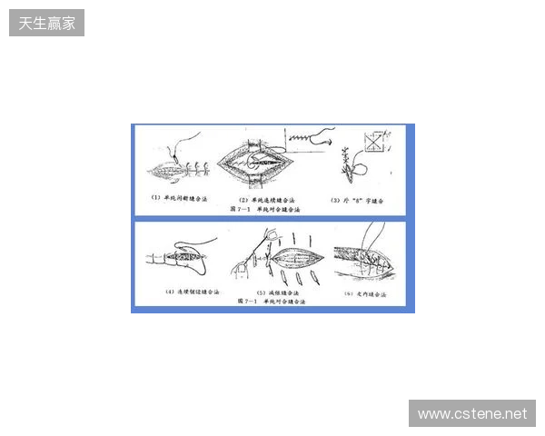 广州豹官方:杨浩眉弓伤口缝合30余针,预计5-7天后拆线 广州豹官方:杨浩眉弓伤口缝合30余针,预计5-7天后拆线